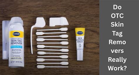 Say Goodbye to Embarrassing Skin Tags with Affordable Removal Costs!