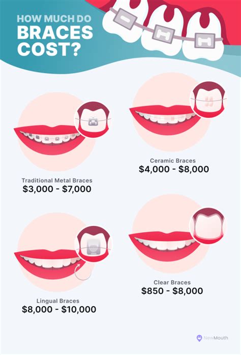 Costs and Payment Options for Braces