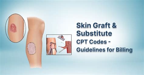 The Ultimate Guide to the Cpt Code for Skin Grafts: Unlocking the Key to Successful Insurance Claims!