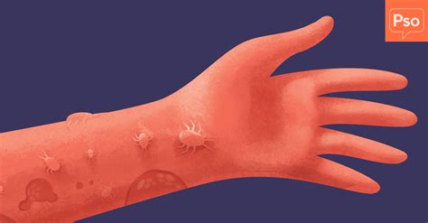 Unraveling the Enigmatic Depth: The Intricate Meaning Behind Crawling in My Skin - A Closer Look into Linkin Park's Iconic Anthem.