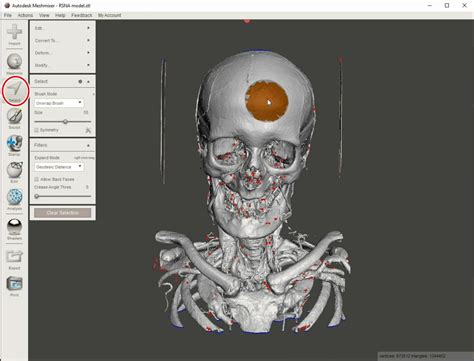 Creating 3D Printable Medical Models For Free: Embodi3D.com, 3D Slicer,