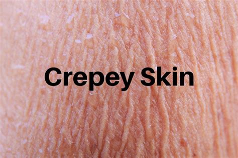 Crepey