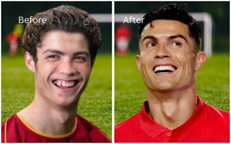 Cristiano Ronaldo Teeth Evolution