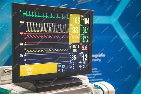 Critical Care and Monitoring