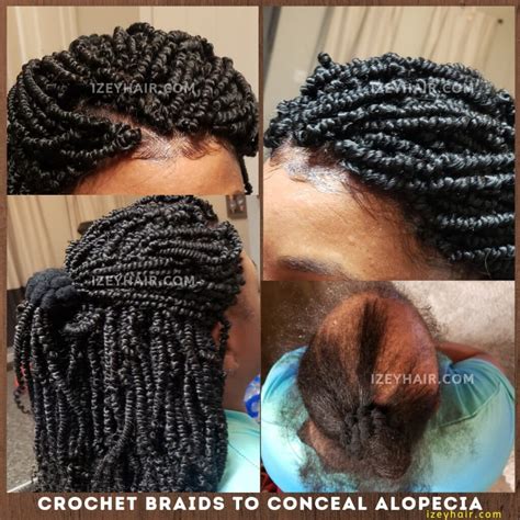 Crochet Braids For Alopecia