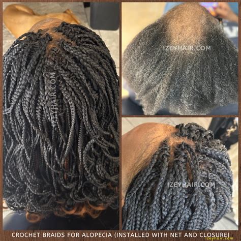 Crochet Braids With Alopecia