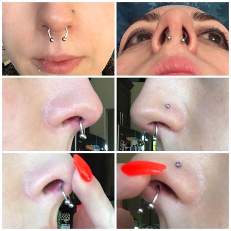 Crooked Septum Piercing Symptoms