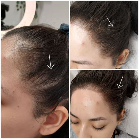 Unleash the Splendor of Glowing Skin with Crystal Pure Skin Care - The Ultimate Choice for An Exquisite Radiance