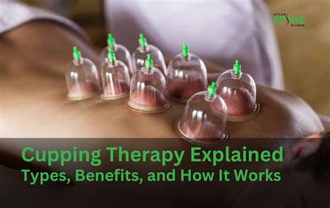 Cupping Therapy Session Philadelphia