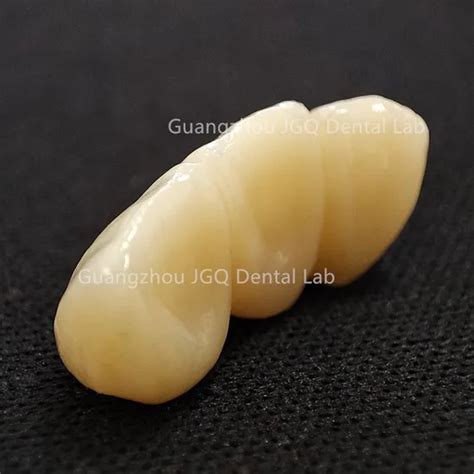 Customization Options for a Natural Fit