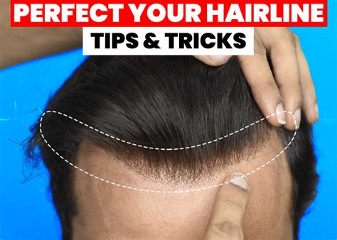 Customizing Your Hairline for a Natural Look