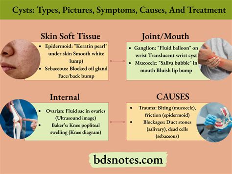 Cysts: Types, Causes, & Treatment Options