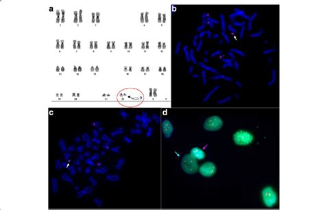 Cytogenetic Analysis Test and interpretation