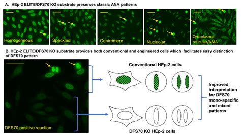 Cytoplasmic Pattern Detected