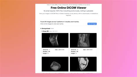 DICOM images