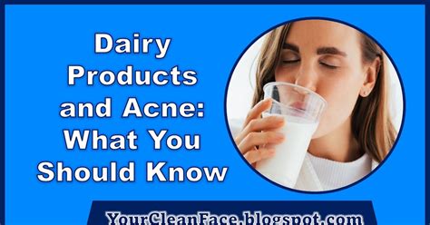 Acne and Dairy Products Dr. Health Clinic Homepage