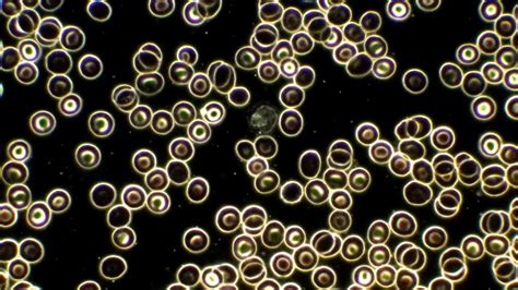 Darkfield Microscopy Test and interpretation