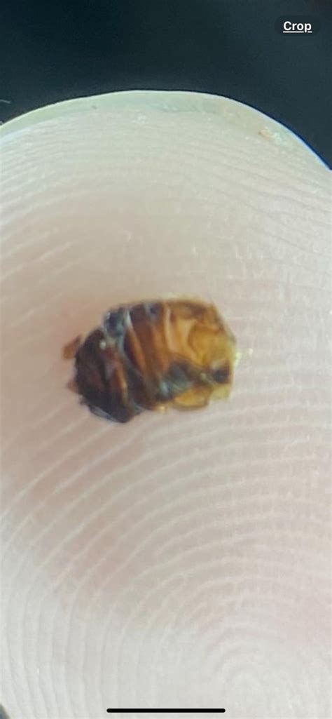 Unveiling the Gruesome Truth: The Surprising Revelation of Dead Skin Floating in Your Hot Tub