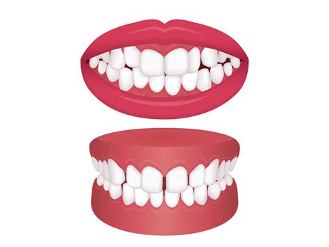 Dealing with Crowding and Spacing