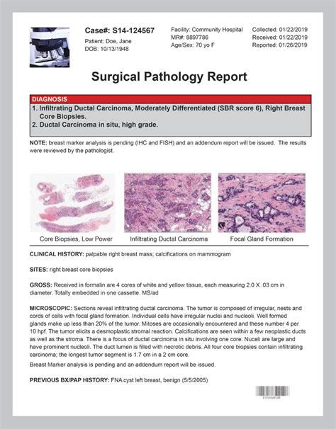 Decode Your Cancer Pathology Report Now