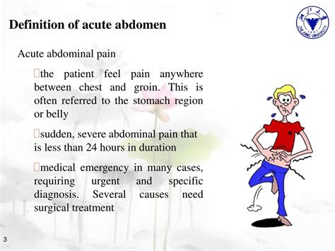 Unveiling the Mystery: Decoding the Definition of Acute Abdomen