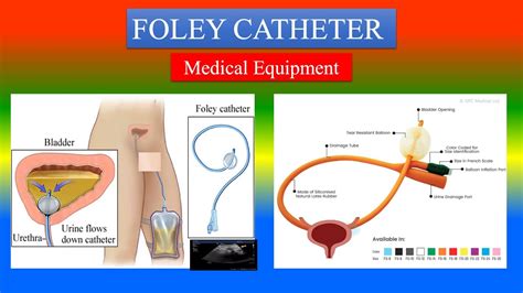 The Ultimate Guide to Foley Catheters: Unveiling the Definition and Functionality of this Vital Medical Tool