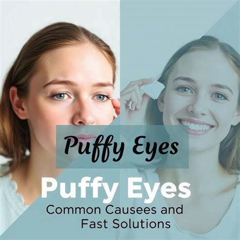 Deflate Puffy Eyes: Fast Relief & Tips