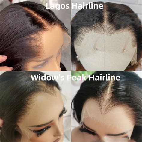 Density and Hairline Customization