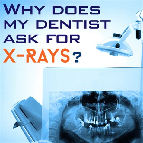 Dental X-rays Importance