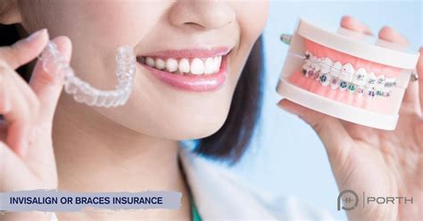 Dental insurance for braces coverage