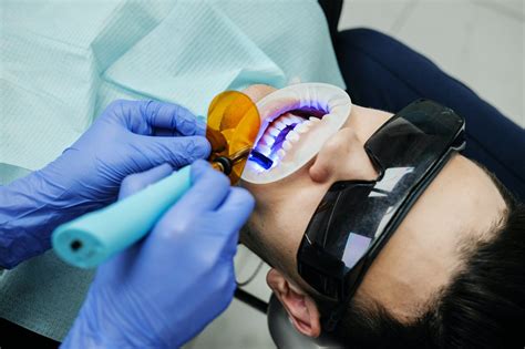 Dental insurance for dental bonding