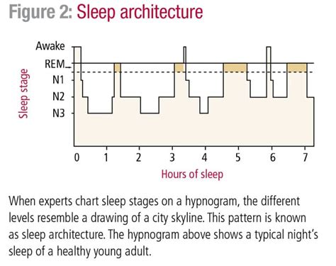 Depression and sleep architecture changes