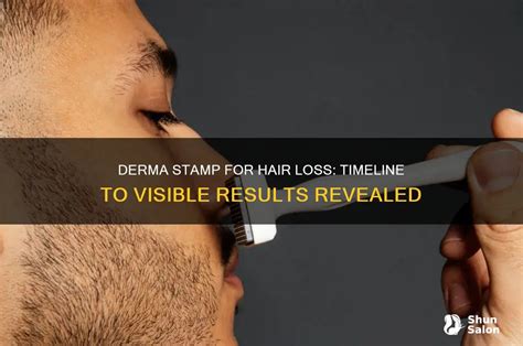 Derma Stamp Dk Remarkable Results