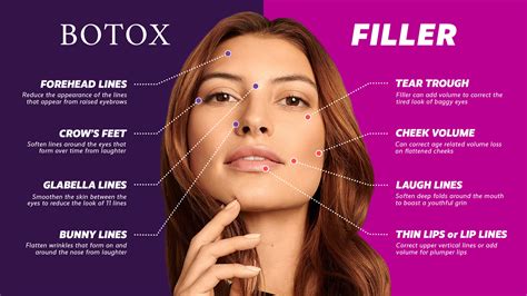 Dermal Fillers and Botox