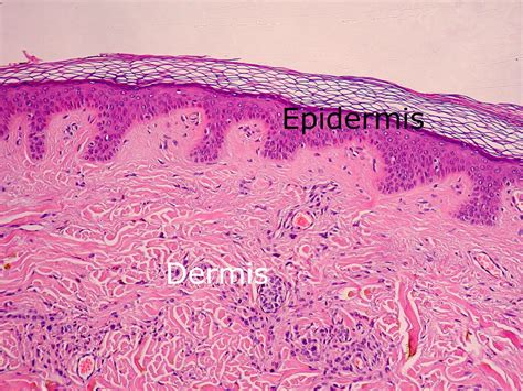 Dermis