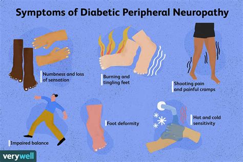 Diabetic Neuropathy and Balance