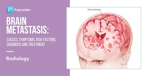 Diagnosing Brain Metastasis