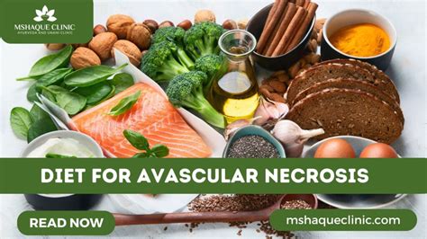 Diet For Avascular Necrosis