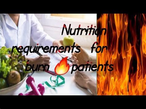 Diet For Burn Patient