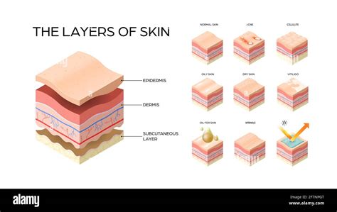 Different Types of Layers