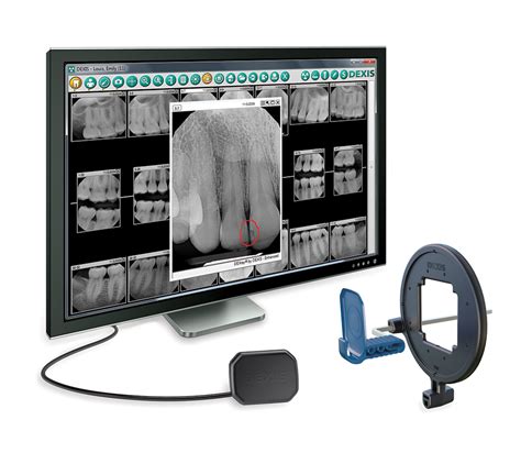 The Remarkable World of Digital Imaging in Dentistry: Unveiling the Cutting-Edge Definition!