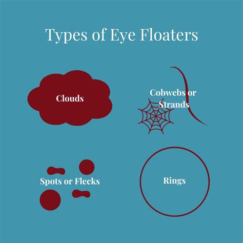 Distinguishing Normal Floaters from Serious Ones
