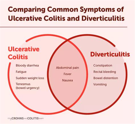 Diverticulitis vs. Ulcerative Colitis: Key Differences in Treatment