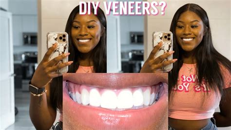 Diy Teeth Veneers