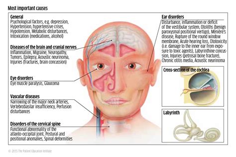 Dizziness & Nausea Relief: Find Your Solution.