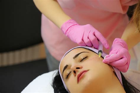 Do facial fillers harm skin by stretching it?