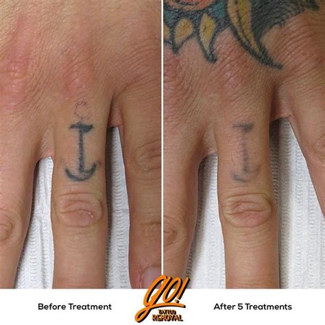 Do Finger Tattoo Fade
