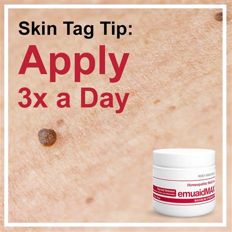 Effective Skin Tag Removal with Emuaidmax