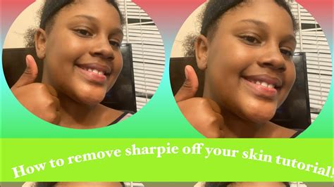 The Frustration and Relief of Removing Sharpie Stains from Skin