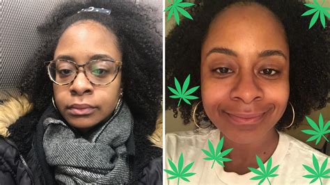 Can Weed Improve Your Skin? Discover Its Effects!